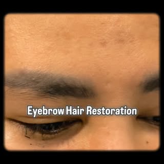 Microblading fades…
Real hair stays ✨ 😉 #BrowGoals #hairrestoration