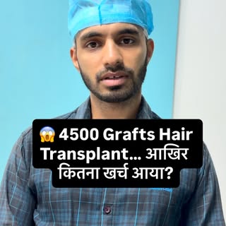 🔥 4500 Grafts Hair Transplant — कुल खर्च कितना आया? 😱💰

आज हमारे क्लाइंट खुद Reveal करेंगे अपना 4