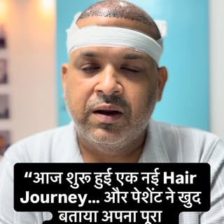 🔥 TODAY’S HAIR TRANSPLANT JOURNEY — PATIENT FEEDBACK 🔥

“आज Hair Transplant Complete… लेकिन असली क