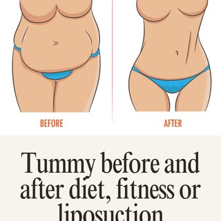 Fat & Lean Abdomen and Hips: Tummy Before & After.

Achieving a healthier-looking abdomen and hip ar