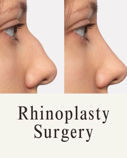 Considering a Nose Job in Cairo?

Your nose plays an important role in facial harmony—and the right 