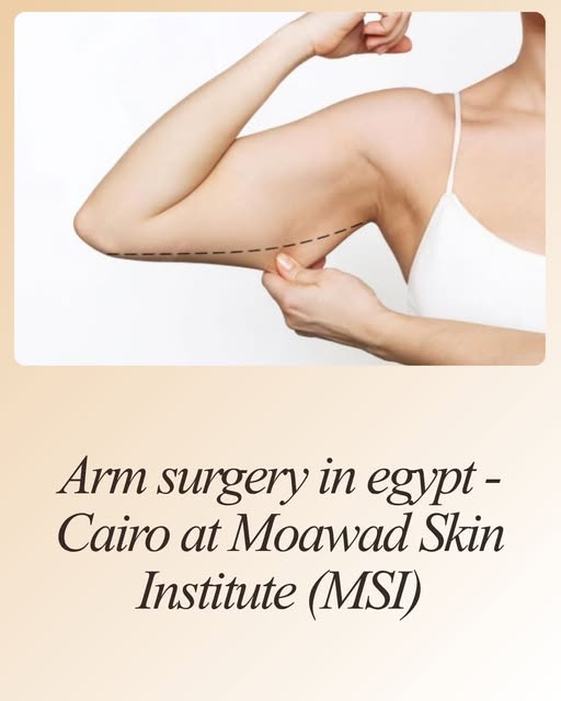 Ready to embrace confident, sculpted arms?

At Moawad Skin Institute (MSI) in Cairo, our expert cosm