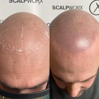 Are you looking for a natural way to reduce the appearance of thinning hair or baldness? Look no fur