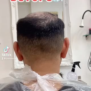 Monday vibes. 

Trust the process. It’s his hair, he paid for it. 

.
.
.
.
.
.
.
.

#hairloss #mens