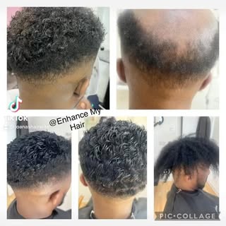 Happy Father’s Day to all. Dm us for all your hair loss needs. Dont live with hair loss. Call us now