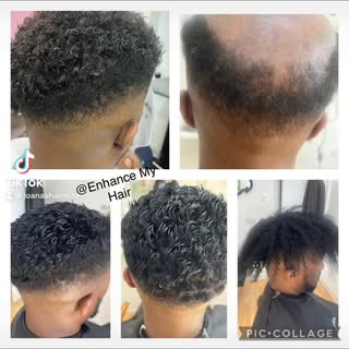 HAPPY FATHERS DAY 

Hair loss can affect confidence, it’s about self esteem and feeling good again. 