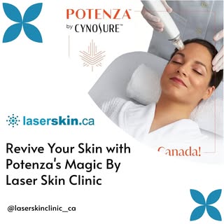 Unlock the secret to revitalized skin with Cynosure Potenza. Our clinic specializes in transforming 