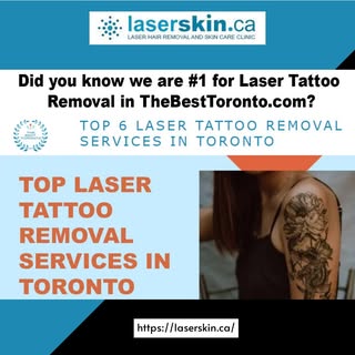 Have an unwanted tattoo? Explore our top-notch LASER TATTOO REMOVAL services in Toronto. Our advance