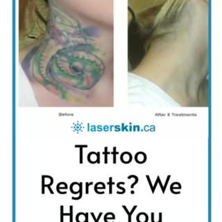 Regretting a tattoo? Let our PicoSure laser come to the rescue. We offer a quick and safe solution t