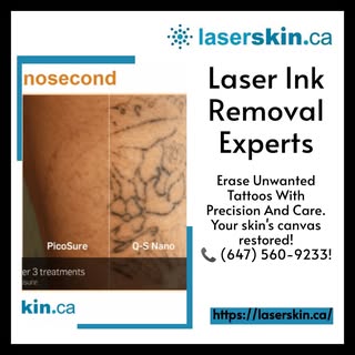 Do your unwanted tattoos make it hard for your skin to shine? Let us help bid farewell to that unwan
