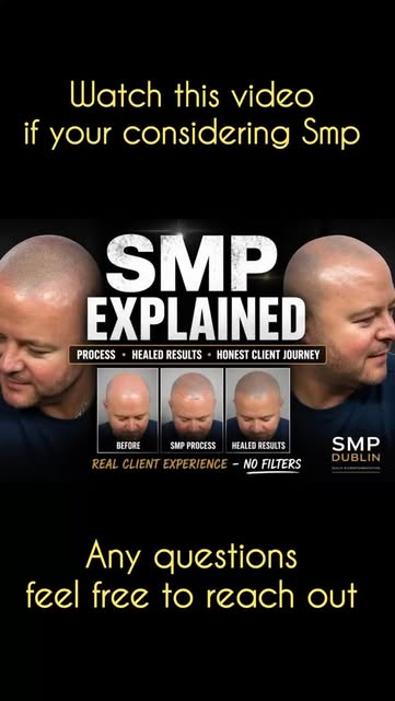 For potential clients considering getting SMP we cover a couple of the key questions regarding the t