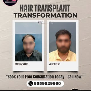 At Marvelous Aesthetics, we believe hair restoration is about more than just follicles—it’s about ho