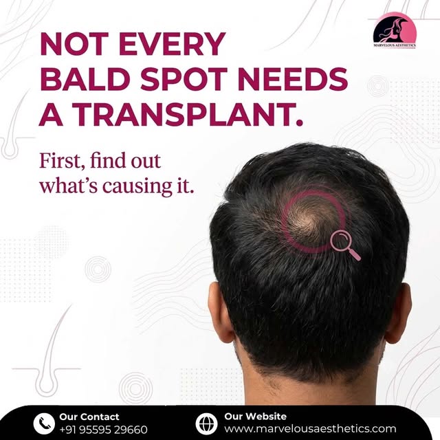 Not every bald spot needs a transplant. 🧑‍⚕️

Hair loss can have different causes, and the right ap