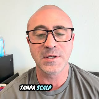 The customer tells me there shopping around for Scalp Micropigmentation. 🤦🤦🤦🤦🤦. Cheap SMP and g