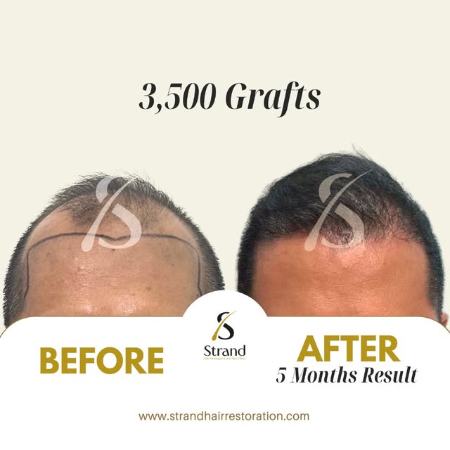 BEFORE and AFTER | Check out this incredible result! ✨
📩 Book a free online consultation! 
📳 Conta