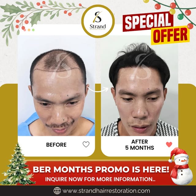 Real results, real transformation—see the difference before and after!
BER Months Promo is Here! 🎉
