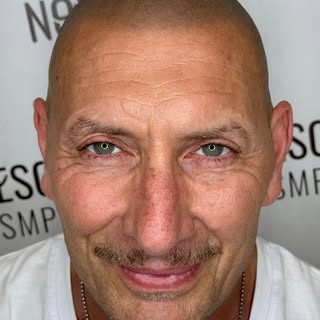 L’hairline non è solo una linea. È ciò che incornicia il viso, definisce i lineamenti e cambia compl