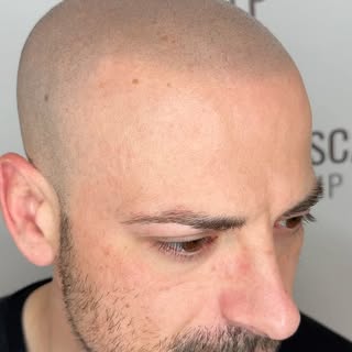SMP after 3 YEARS ⚠️ 3 ANNI DOPO 
➡️ TOUCH UP / ritocco

Il pigmento appare ancora naturale. ✨

Ecco