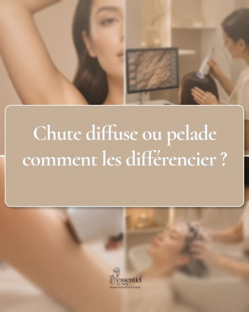 Savez-vous que deux types de chute de cheveux peuvent se ressembler, mais révéler des réalités de sa
