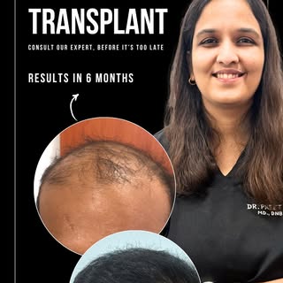 🎥 Thinking about a hair transplant?
Here are 3️⃣ things you must know before taking the plunge 👇

