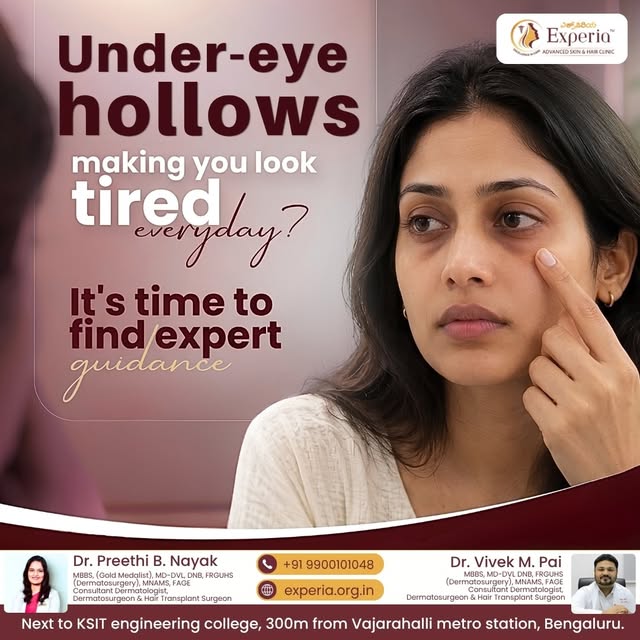 👀 Under-eye hollows making you look tired even after a good night’s sleep?

Sometimes, it’s not fat