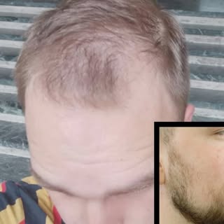 ✨ Transformation Step by Step ✨

Hier seht ihr die einzelnen Schritte der Transformation von Marek, 