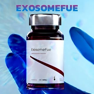 Are you ready to meet Exosome Fue, the Newest Technique in Hair Transplantation?
Getting 100% result