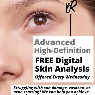 ✨ Free Skin Analysis Wednesdays! ✨

Struggling with sun damage, rosacea, or acne scarring? We can he