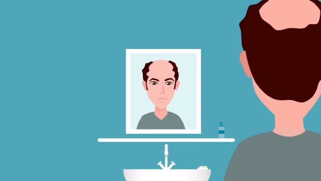 Haartransplantation, 
wo und wann? ……leicht erklärt:

📞 Kontaktieren sie uns:

Info@siegaesthetik.d