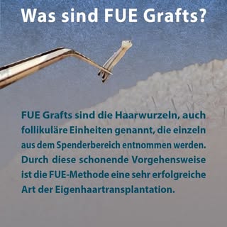 * Unser Experten-Team berät Sie gerne zu allen Fragen rund um Haartransplantationen * 

Dr. med. Ann