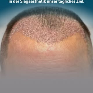 "Lassen Sie uns gemeinsam die beste Lösung für Ihre Haarprobleme finden - kontaktieren Sie unser Tea
