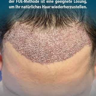 ‏“Wir laden Sie ein, sich eingehend über Haartransplantationen zu informieren. Von den modernen Meth
