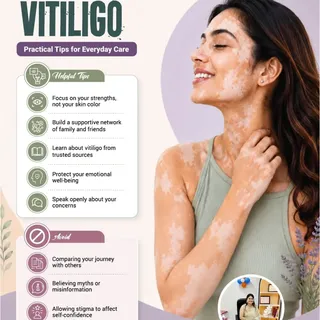 World vitiligo day 
🪩

#laser 
#hairideas 
#vitiligo 
#skintreatment 
#hairideas