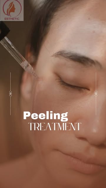Peeling 🖌️

By
@dr.monica_dhruv 🩺
#skincare
#skingoals 
#skincareroutine 
#peel 
#peeloffmask