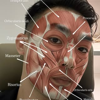 In aesthetics, knowing facial muscles means safer and natural results

👀 Eyes – crow’s feet (orbicu