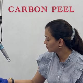 CARBON PEEL aka CARBON LASER :

This treatment consists of applying a carbon mask to the face for ab