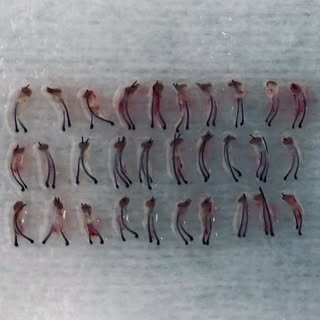 Sogar Haarfollikel bei Kraushaar sind hervorragend transplantierbar. Alles wird penibelst präpariert