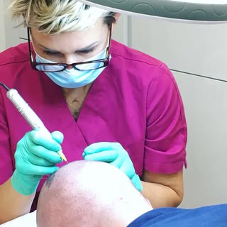 #microhairpigmentation Ganz filigran werden die Farbpixel einzeln unter die Kofphaut injiziert.  Wir