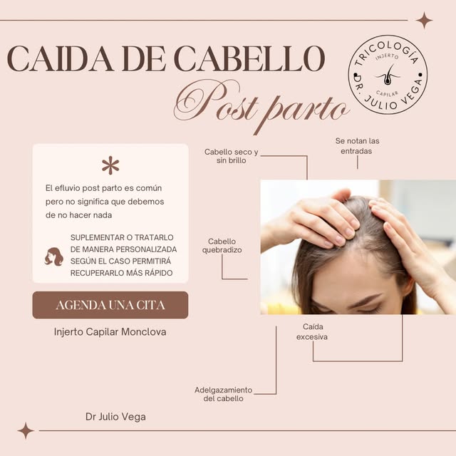 ¿Notas más caída de cabello después del parto? 🤎

La caída de cabello postparto es muy frecuente y 