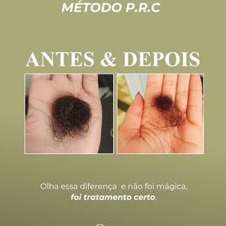 Cada caso precisa ser investigado para entender a verdadeira causa da queda. Só assim é possível def