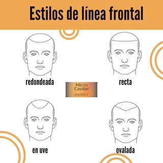 Existen diversos estilos de línea frontal y en micro capilar institut nos aseguramos de escoger el q