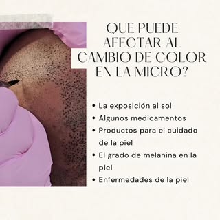 #micropigmentation #micropigmentacioncapilar #micro #micropigmentacionbarcelona #microbcn