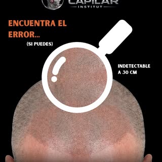 Hagamos un juego: Desliza y dime dónde termina el pelo y dónde empieza la micropigmentación. 🔍

En 