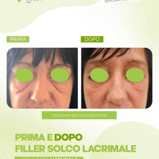 👀 Il contorno occhi è una delle zone più delicate del viso: basta poco perché stanchezza, ombre e s