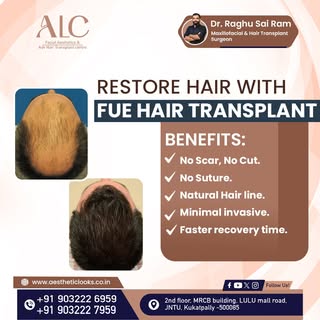 💇‍♂️ Say hello to fuller, natural-looking hair with FUE Hair Transplant! Get long-lasting results w