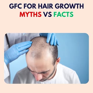 Think GFC is a magic fix for hair loss? 🤔 Let’s separate facts from fiction! 🧬💇‍♂️ Discover what 