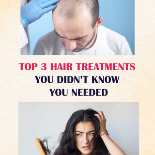 💇‍♀️ Hair fall, thinning, or bald patches? Don’t worry—advanced solutions are here! 🌟 Discover the