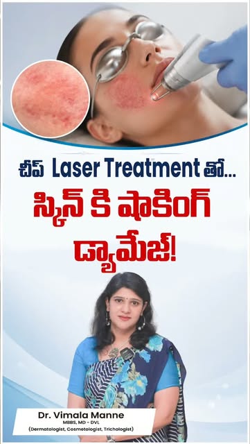 చీప్ Laser Treatment‌తో Skinకి షాకింగ్ Damage? 😱

Laser treatment చేయించుకునే ముందు కేవలం price మాత
