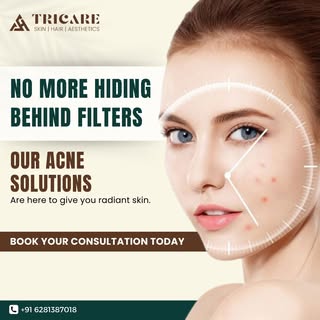 No more hiding behind filters!
Our acne solutions are here to give you radiant skin.

#tricareclinic