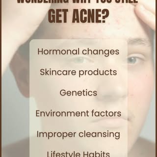 WONDERING WHY YOU STILL GET ACNE?
. Hormonal changes
. Skincare products
. Genetics
. Environment fa